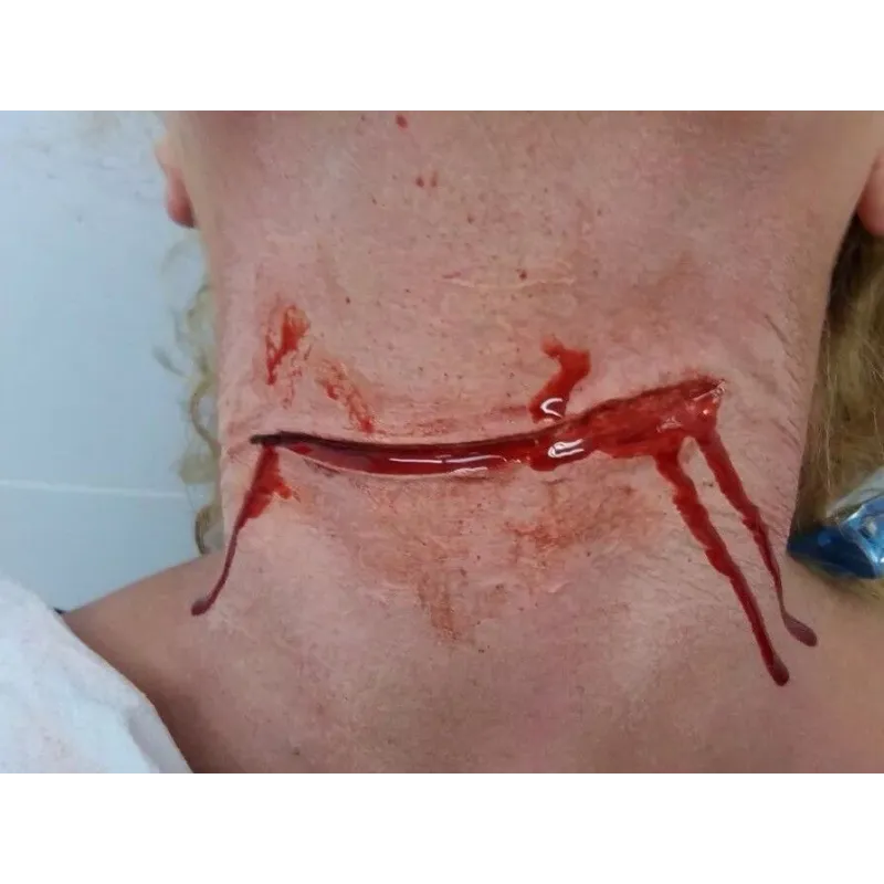 Corte Abierto ∣ Harpo