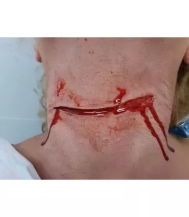 Corte Abierto ∣ Harpo