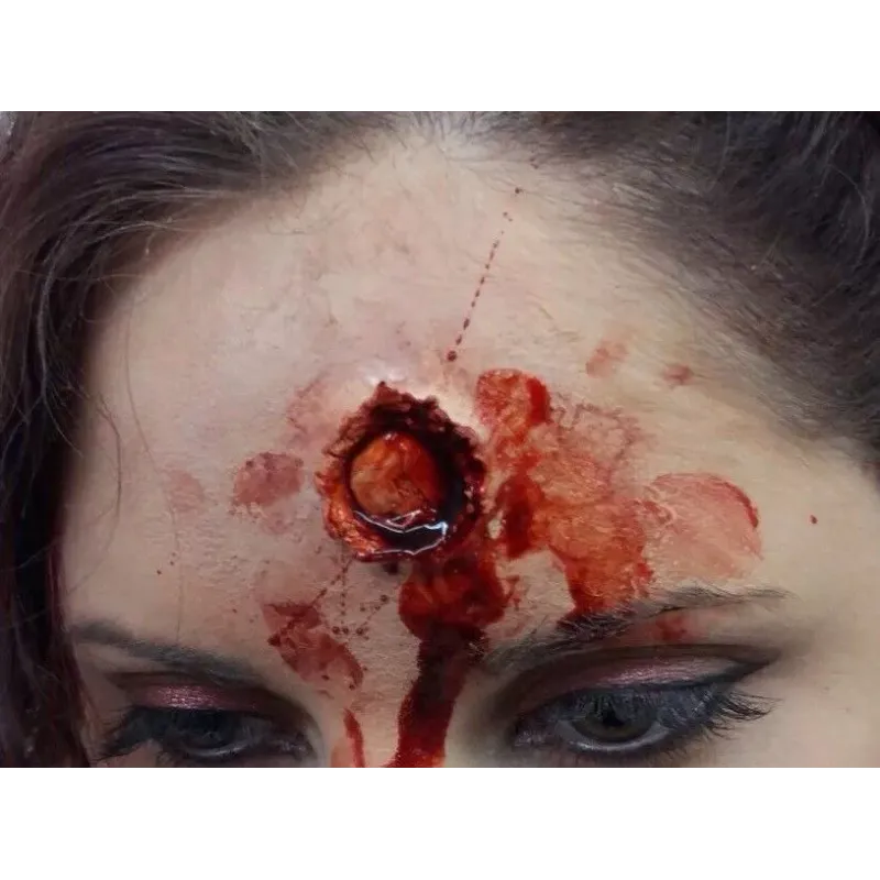 Herida Bala Salida ∣ Harpo