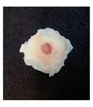 Herida de Bala Entrada ∣ Harpo