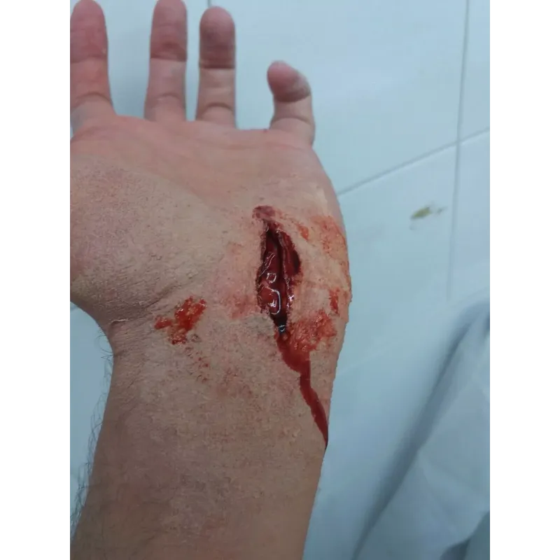 Corte Abierto 1 ∣ Harpo