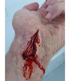 Corte Abierto 2 ∣ Harpo