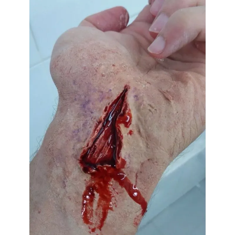 Corte Abierto 2 ∣ Harpo