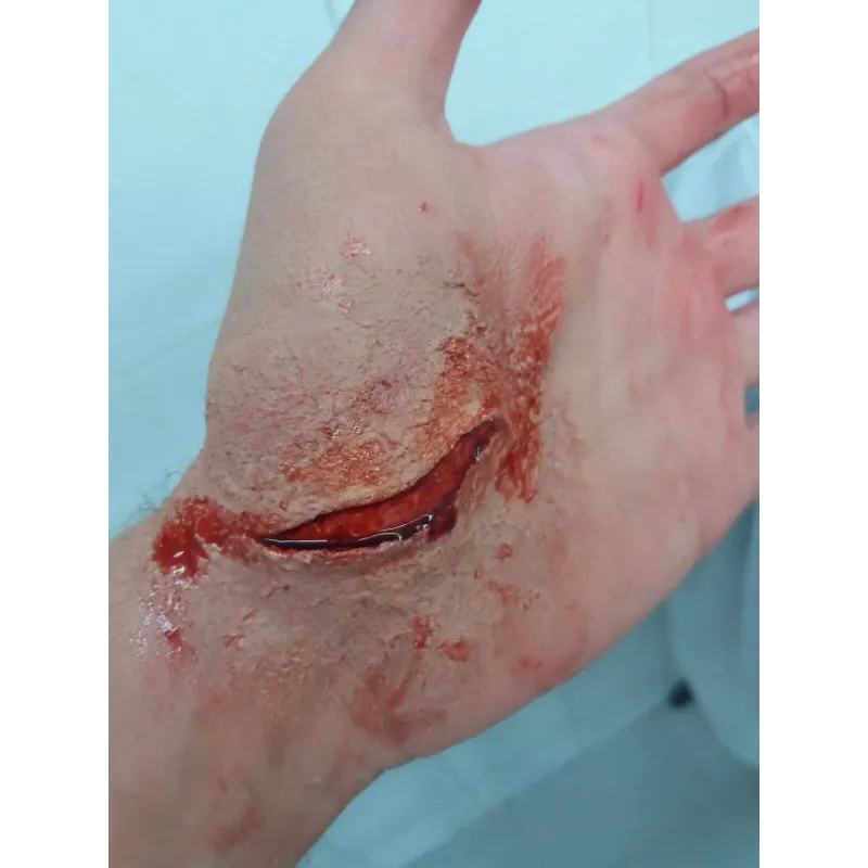 Corte Abierto 3 ∣ Harpo