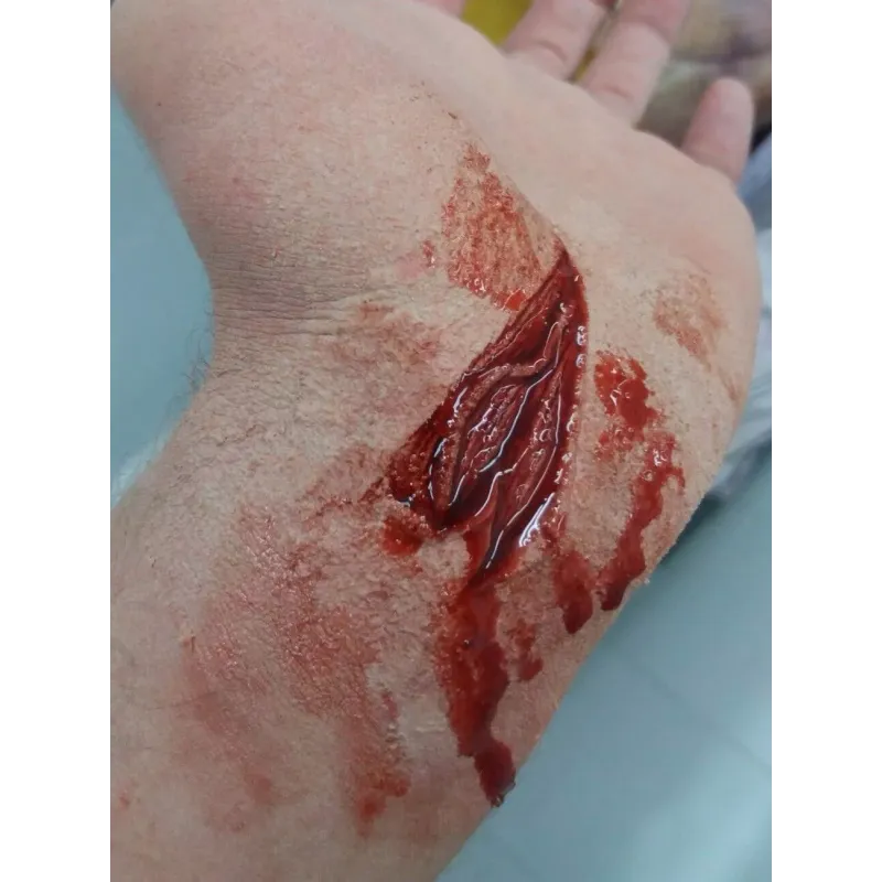 Corte Abierto 4 ∣ Harpo