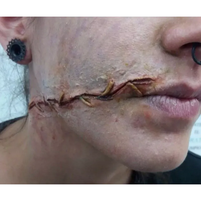 Herida Molde 3 ∣ Harpo