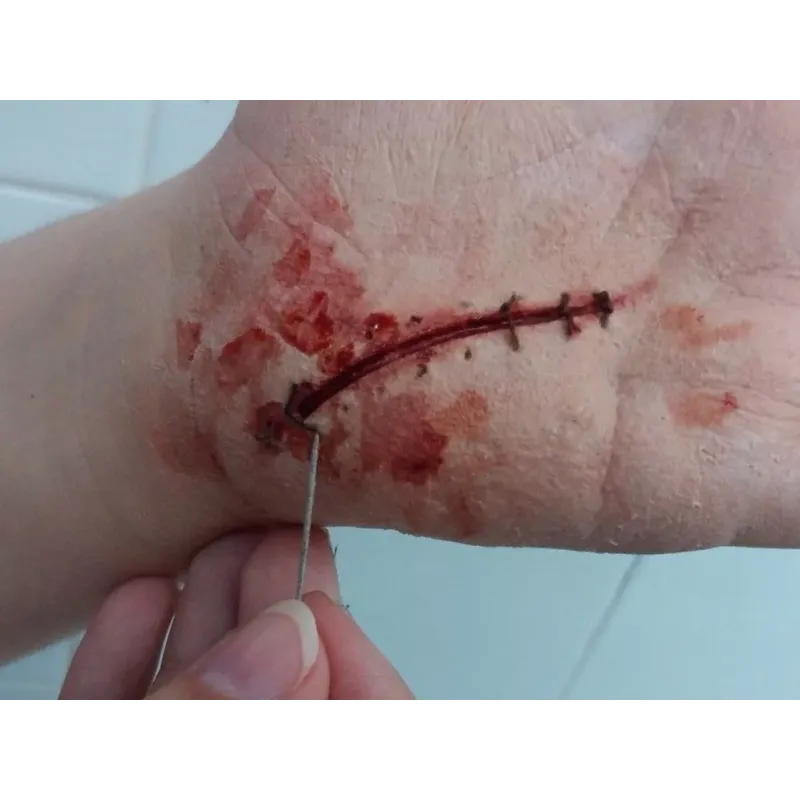 Herida Puntos ∣ Harpo