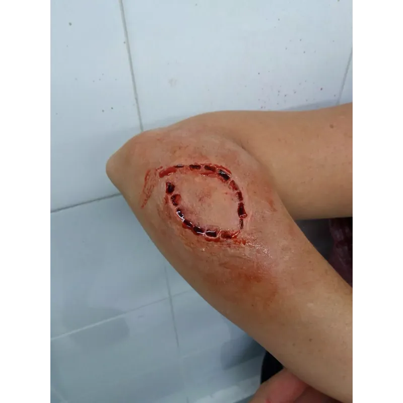 Mordisco Grande ∣ Harpo