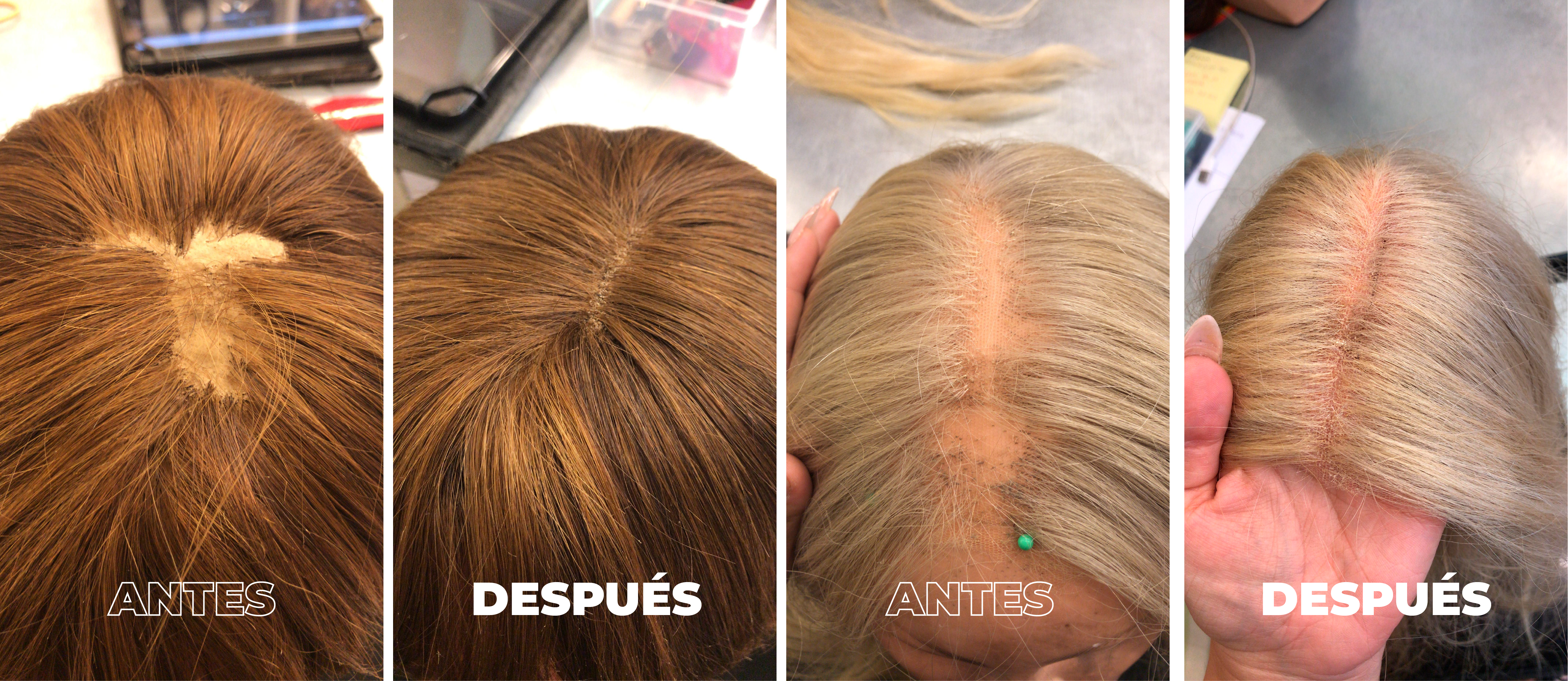 Posticería HARPO HRP